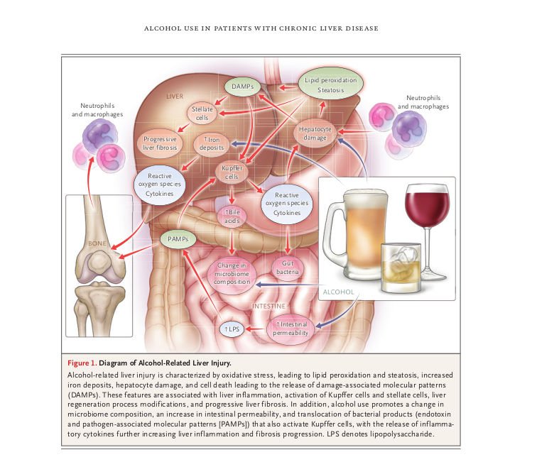 Alcohol Use in Patients with Chronic Liver Disease