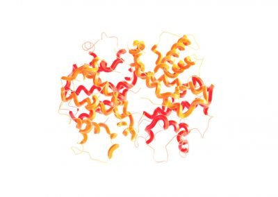 Hepatitis alcohólica: inmunofenotipos, expresión de proteínas plasmáticas y secuenciación de RNA en el diagnóstico precoz de pacientes con trastorno por uso de alcohol